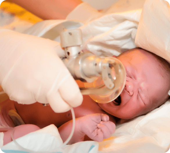 Cerebral Palsy and Erbs Palsy Birth Injury Attorneys