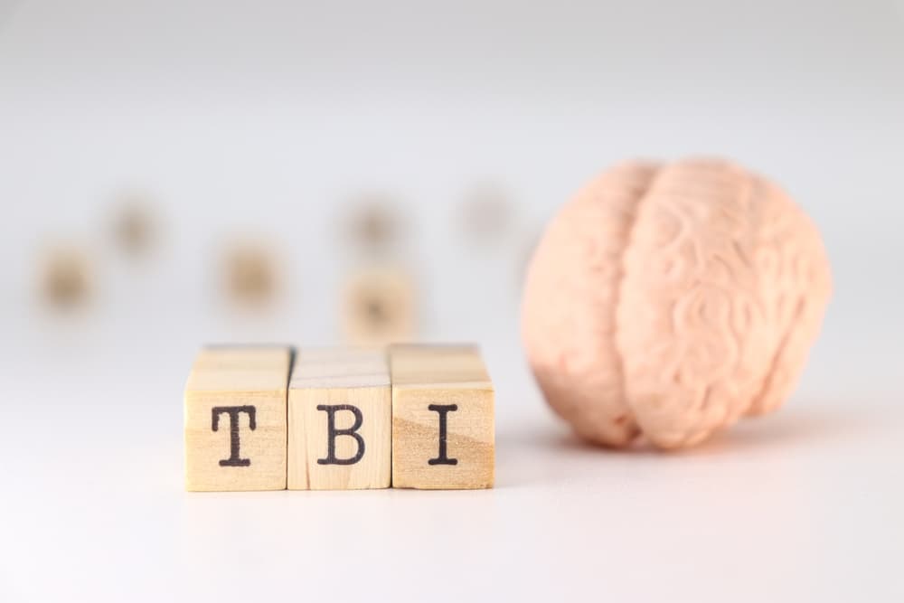 TBI lawyer