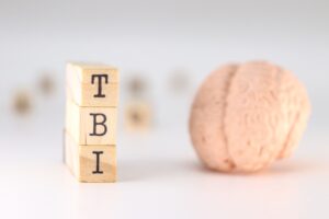 Denver TBI Lawyer